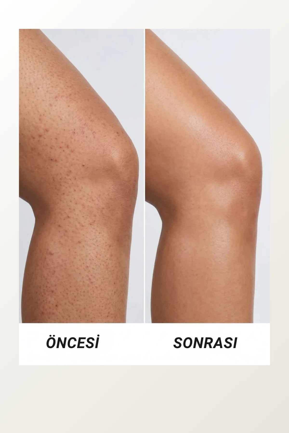 Viajé Vücut Toniği |  Urea + Glycolic Acid Body Toner