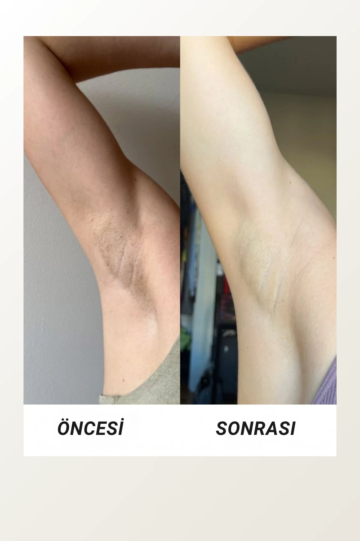 Viajé Vücut Toniği |  Urea + Glycolic Acid Body Toner